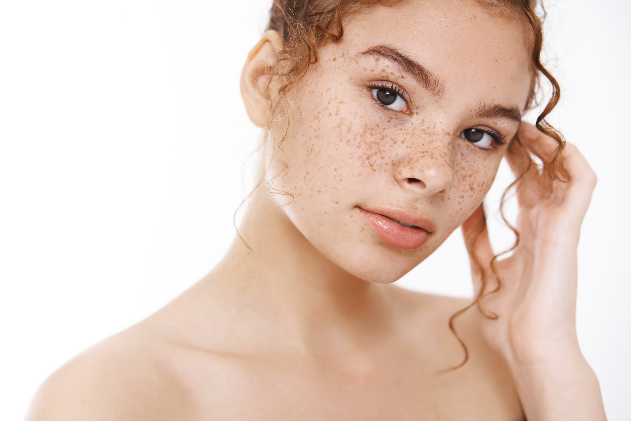freckles treatement and why do they suddenly appear