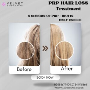 Beige White Minimalist Before After Hair Treatment Instagram Post