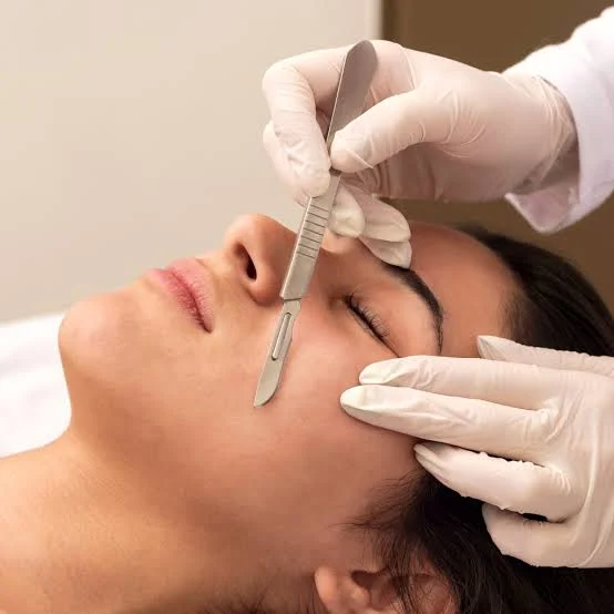 Dermaplaning Before & After