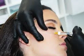 Advanced Dermal Filler Techniques