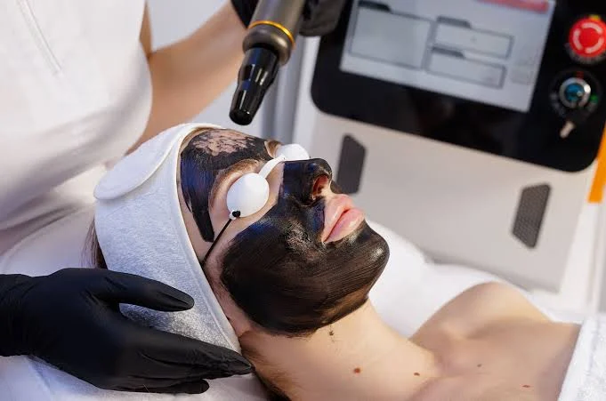 Carbon Peel